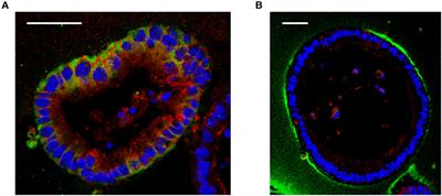 The Role of Hyaluronan Treatment in Intestinal Innate Host Defense